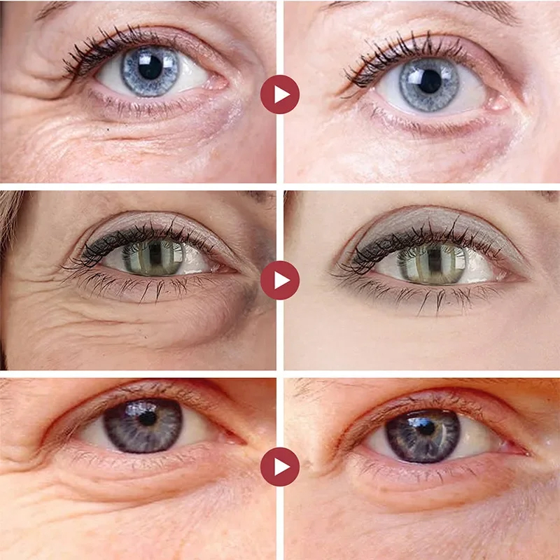 Удаление морщин, патчи для гла – обзор и цена Collagen Eye Patch